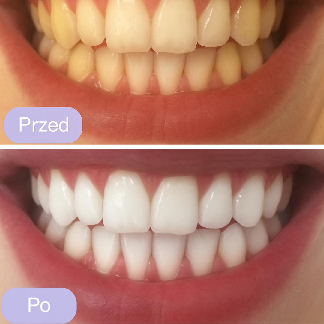 Serum wybielające Smilepop™